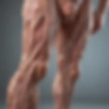 Visualization of muscle fiber degeneration in LGMD