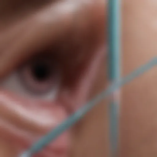 Illustration depicting the catheter used in angioplasty