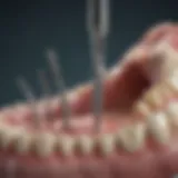 Dental implant procedure showing surgical tools