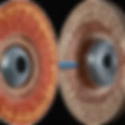 An anatomical illustration of a healthy versus a degenerated intervertebral disc