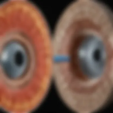 An anatomical illustration of a healthy versus a degenerated intervertebral disc