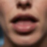 Close-up of a lip lesion indicating potential cancer