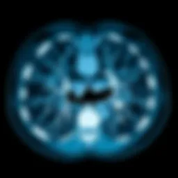 CT scan revealing emphysema-related alveolar damage