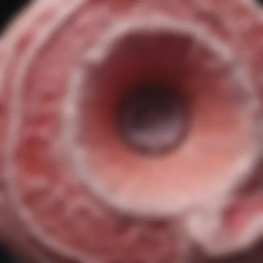 Histological slide showcasing characteristic features of DSRCT