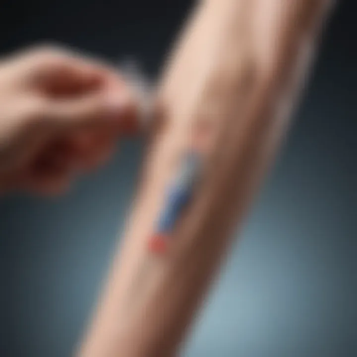 Illustration showing cortisone injection technique