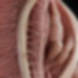 Anatomical illustration of myoma uteri