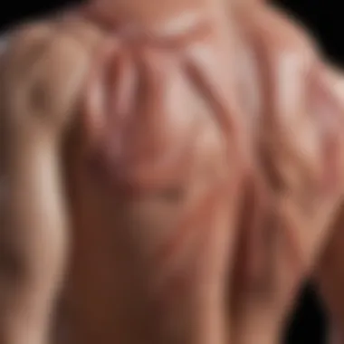 Infographic detailing various types of muscle pains associated with statin usage