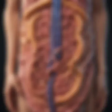 Diagram illustrating hereditary syndromes linked to colon cancer