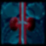 Exploring the Link Between Urinary Tract Infections and Kidney Failure Introduction