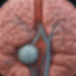 Illustration showing the anatomy of the brain with highlighted areas affected by intracranial stenosis