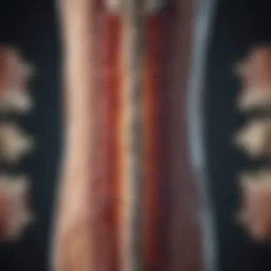 Mechanisms Behind Spinal Cord Compression Illustration depicting the mechanisms of spinal cord compression
