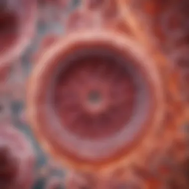 Abundant Mucin in Mucinous Colon Cancer Histological slide of mucinous colon cancer showcasing abundant mucin production