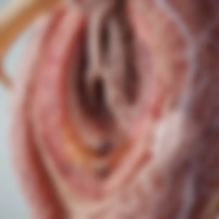 Diagram illustrating the pathophysiology of myoma uteri