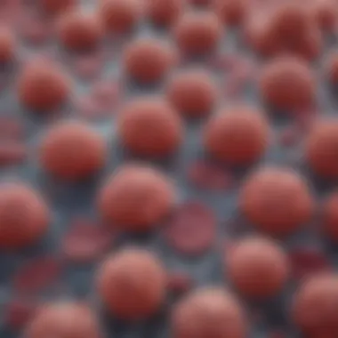 Microscopic Analysis of Hepatocellular Carcinoma Microscopic view of poorly differentiated hepatocellular carcinoma cells