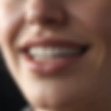 Comparison of whitening methods