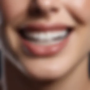 Illustration of teeth whitening process