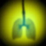 The Interrelation Between COPD and Mental Health Introduction