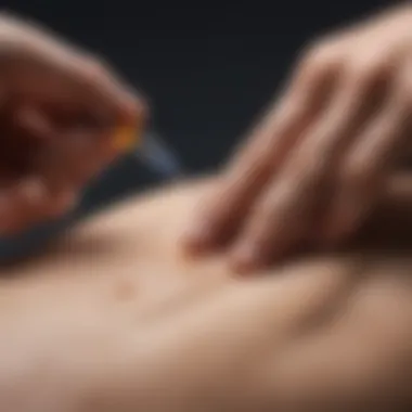 Corticosteroid Injection Technique Explained Visual representation of corticosteroid injection technique