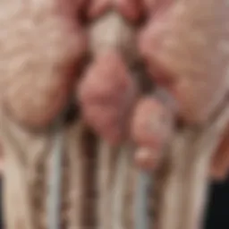 An illustration depicting the anatomical location of Diffuse Pontine Glioma within the brainstem.
