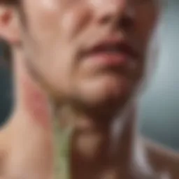 Diagram illustrating the effects of hereditary angioedema on the gastrointestinal system.