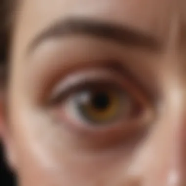 Diagram illustrating macular oedema