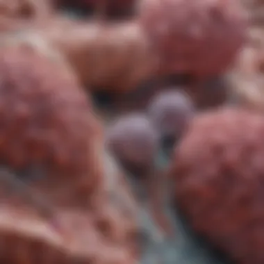 Pathophysiological Mechanisms of Stage 3 NSCLC Pathophysiology of stage 3 non-small cell squamous lung cancer