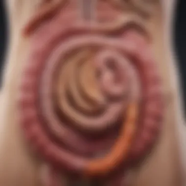 Gastrointestinal Tract Affected by Viral Colitis Illustration showcasing the gastrointestinal tract affected by viral colitis